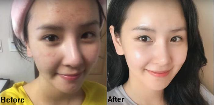 [HCM]Tinh chất The Ordinary Lactic Acid 5% + HA - 30ml