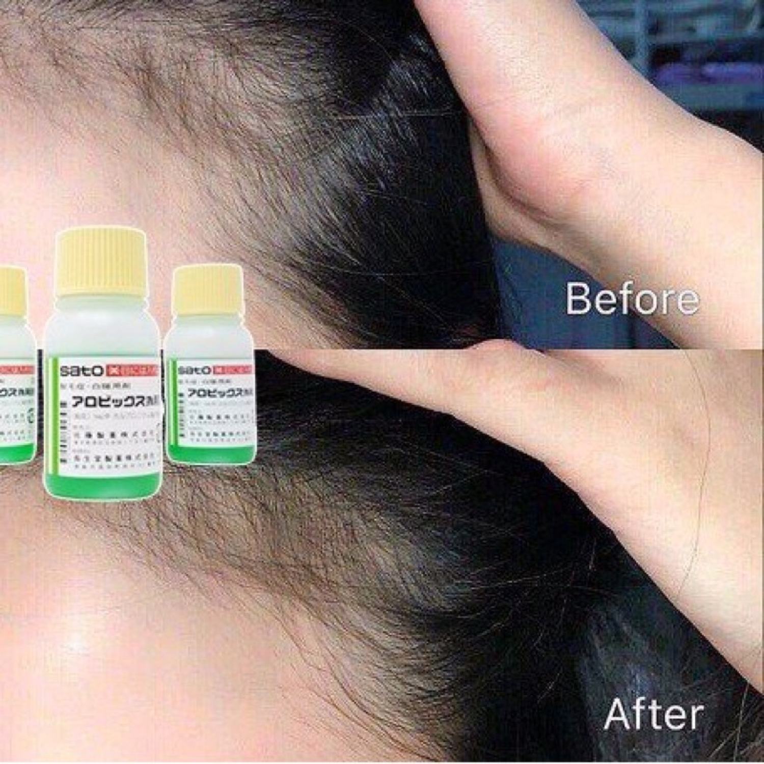 Tinh Chất Kích Thích Mọc Tóc Sato Arovics Solutions 5% Nhật Bản 30ml