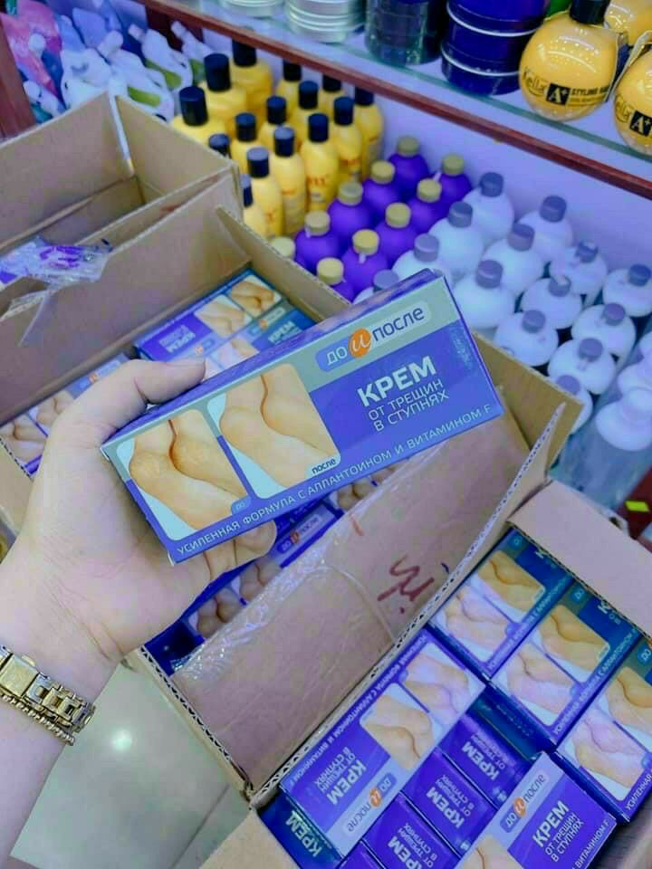 kem nứt gót Nga kpem