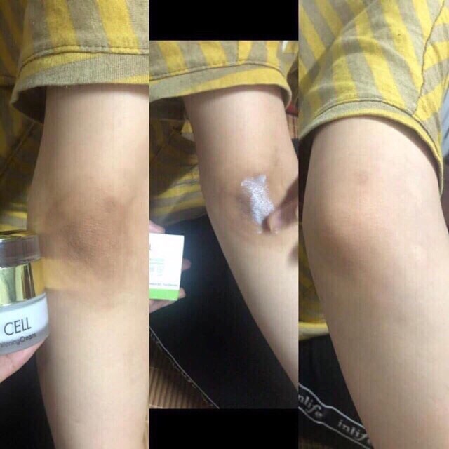 [CHÍNH HÃNG] Kem Trị Thâm Nách Thâm Môi Thâm Đầu Gối OL-CELL