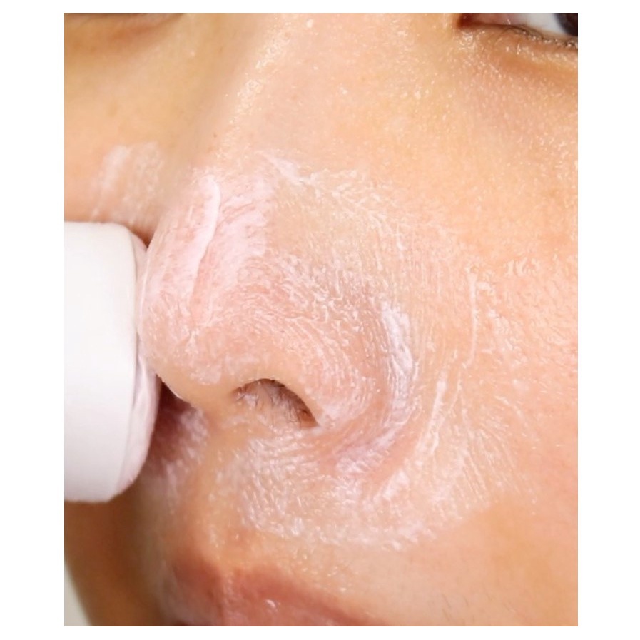 [Sonatural] Thanh Lăn Mụn Đầu Đen RED PEEL - CẬN DATE 11/2023