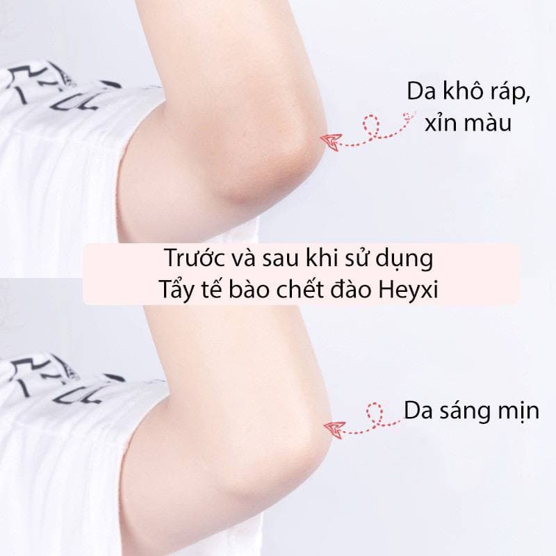 (HCM)Kem Tẩy Da Chết Body Đào HEYXI(Hũ Trắng 200ml)