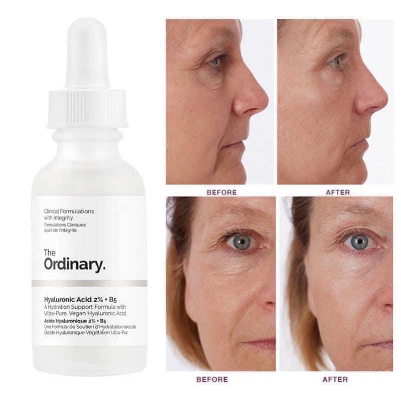 (HCM)The Ordinary Hyaluronic Acid 2% + B5 phục hồi da, cấp ẩm - Serum B5 làm dịu da The Ordinary