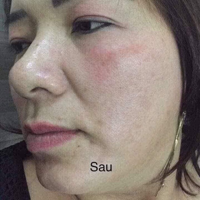 Bộ Meiya cam của Nhật