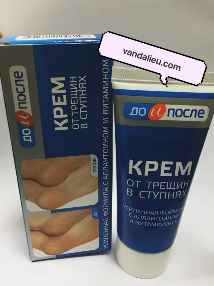 KPEM 50G. KEM NỨT GÓT CHÂN