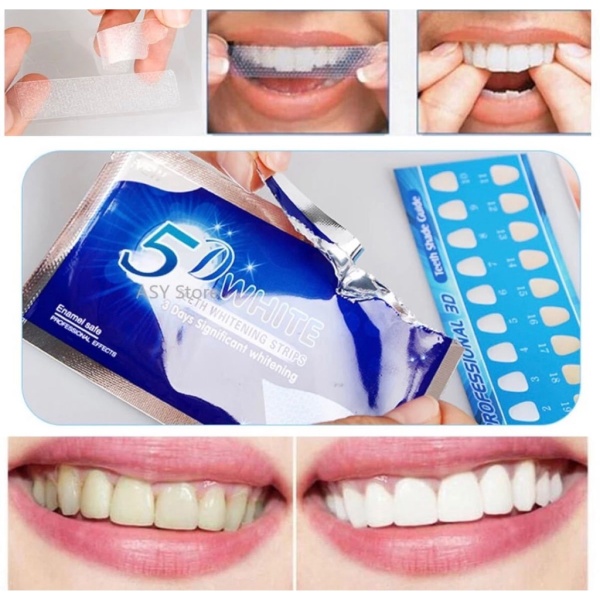 Miếng dán trắng răng 5D TEETH WHITENING, hỗ trợ trắng răng nhanh chóng, tiện lợi chỉ sau vài lần sử dụng