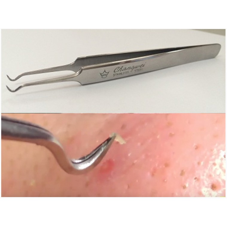 Nhíp Gắp Mụn Đầu Đen Vacosi T07