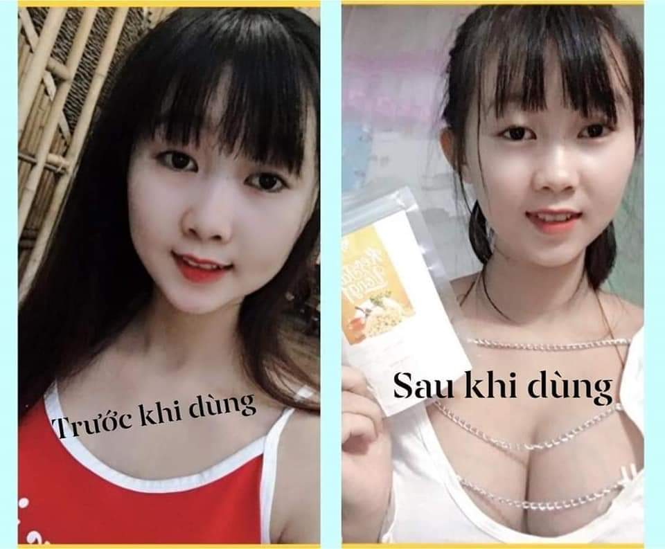 Slimly Vip 10 - Tặng 30v Khoá Cân Collagen