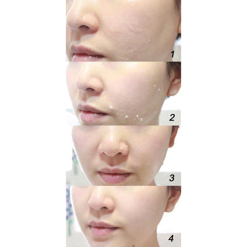 Gói Tẩy tế bào chết Primera 2ml
