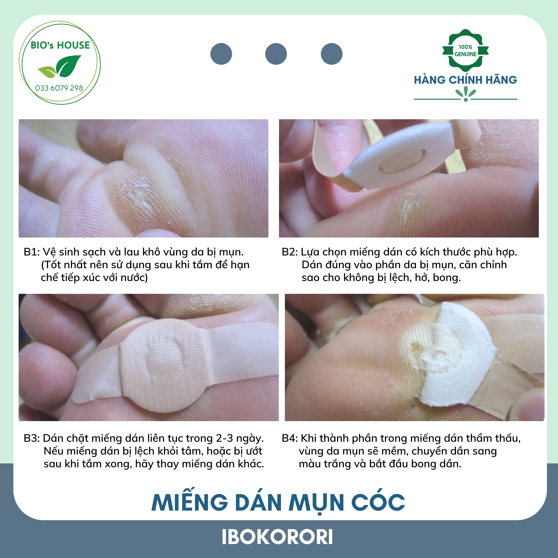 Miếng dán mụn cóc IBOKORORI 12 miếng (Nhật Bản)