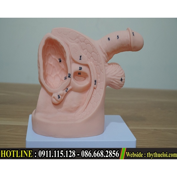 Mô hình đặt sonde tiểu nam