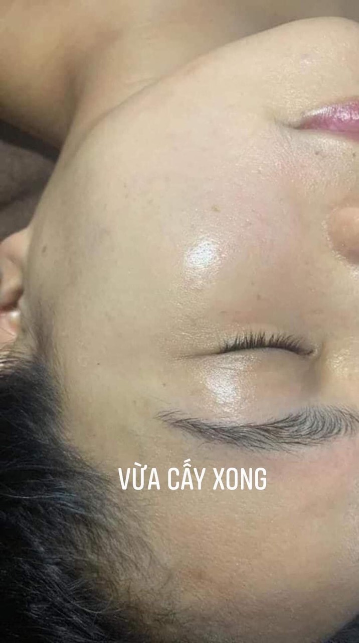 Serum collagen Căng Bóng Da nhân sâm QA ( chính hãng)