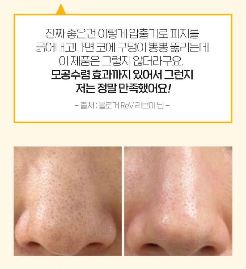 DUNG DỊCH Ủ MỤN ĐẦU ĐEN ME.DI.PELL