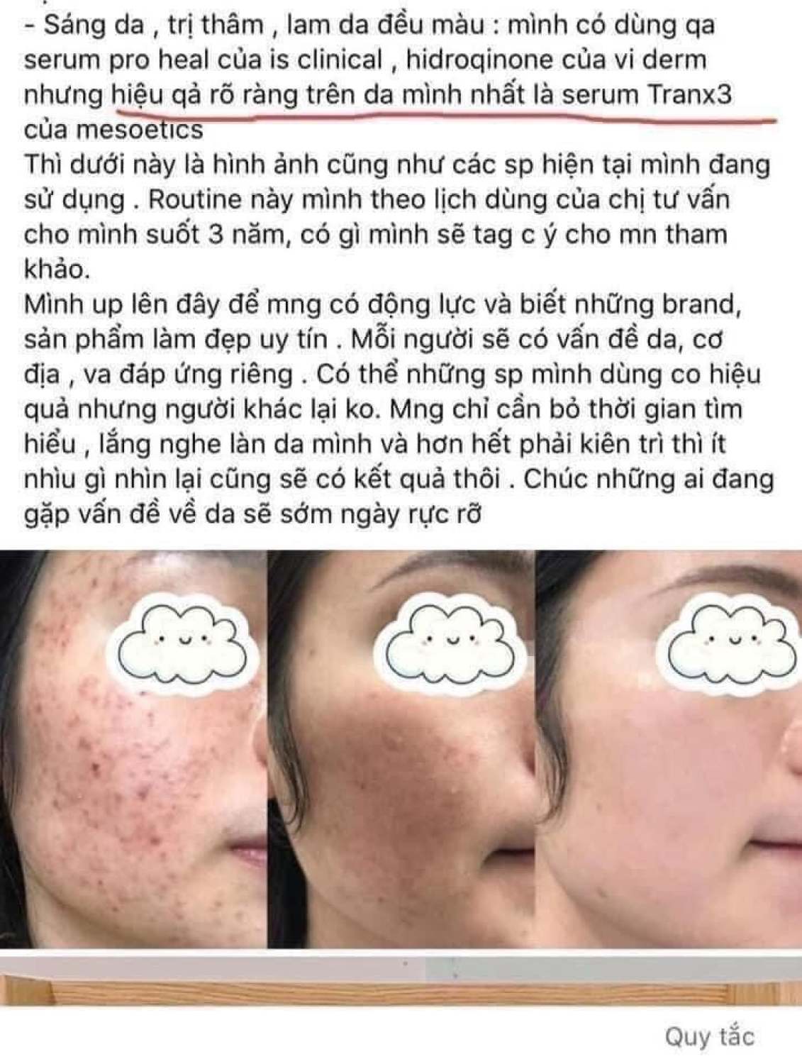 Serum giam ƞám trắng da Melan Tran 3x Concentrate 30ml