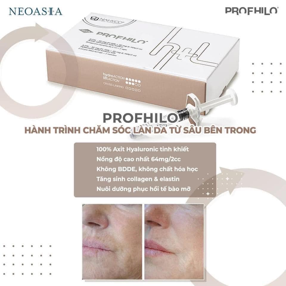 PROFHILO TINH CHẤT CĂNG BÓNG