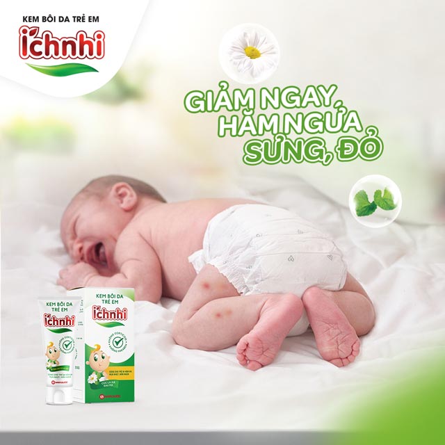 Kem Bôi Da Trẻ Em Ích Nhi tuýp 20g