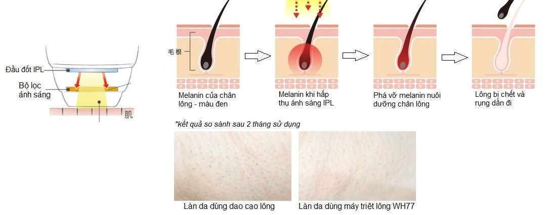 Máy triệt lông Panasonic ES WH77 - Hàng nội địa nhật
