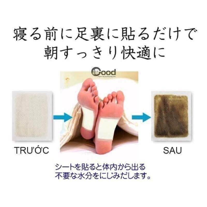 Miếng Dán Chân Thải Độc Kenko 1 hộp 30 miếng