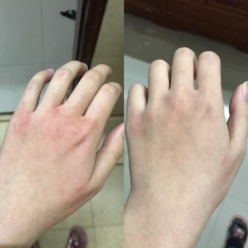 Kem ngừa nứt nẻ da tay khô Eucerin 75ML - Bill Pháp