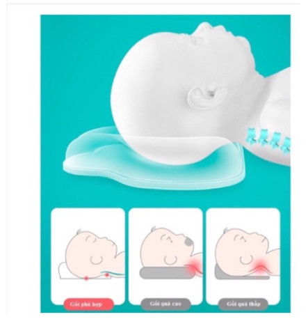 Gối lõm ChocChick hình đám mây giúp tránh bẹp đầu bé