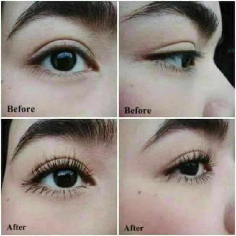 [HCM]Serum Mọc Tóc - Râu - Chân Mày