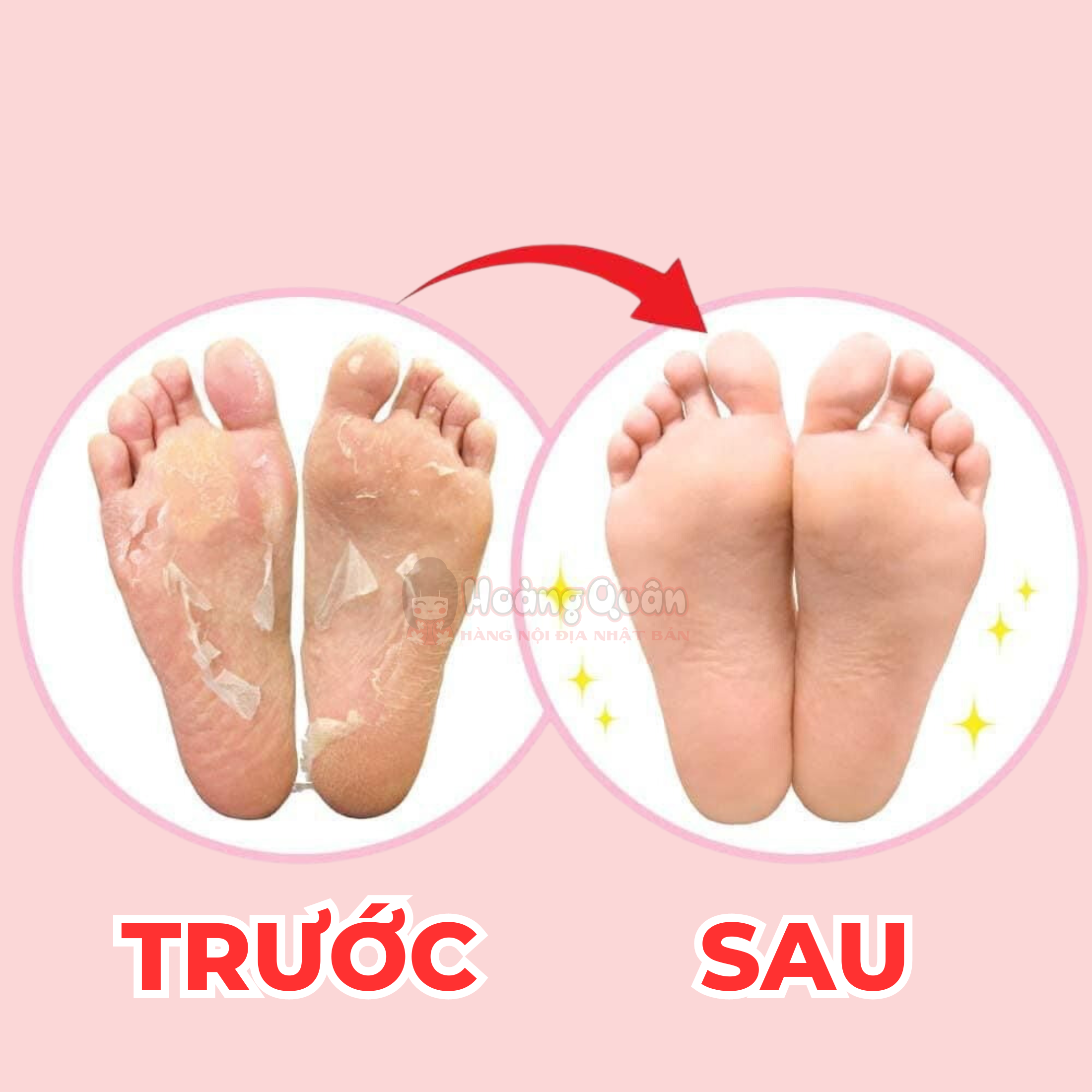 Túi Ủ Tẩy Tế Bào Chết Chân To-Plan Nhật Bản