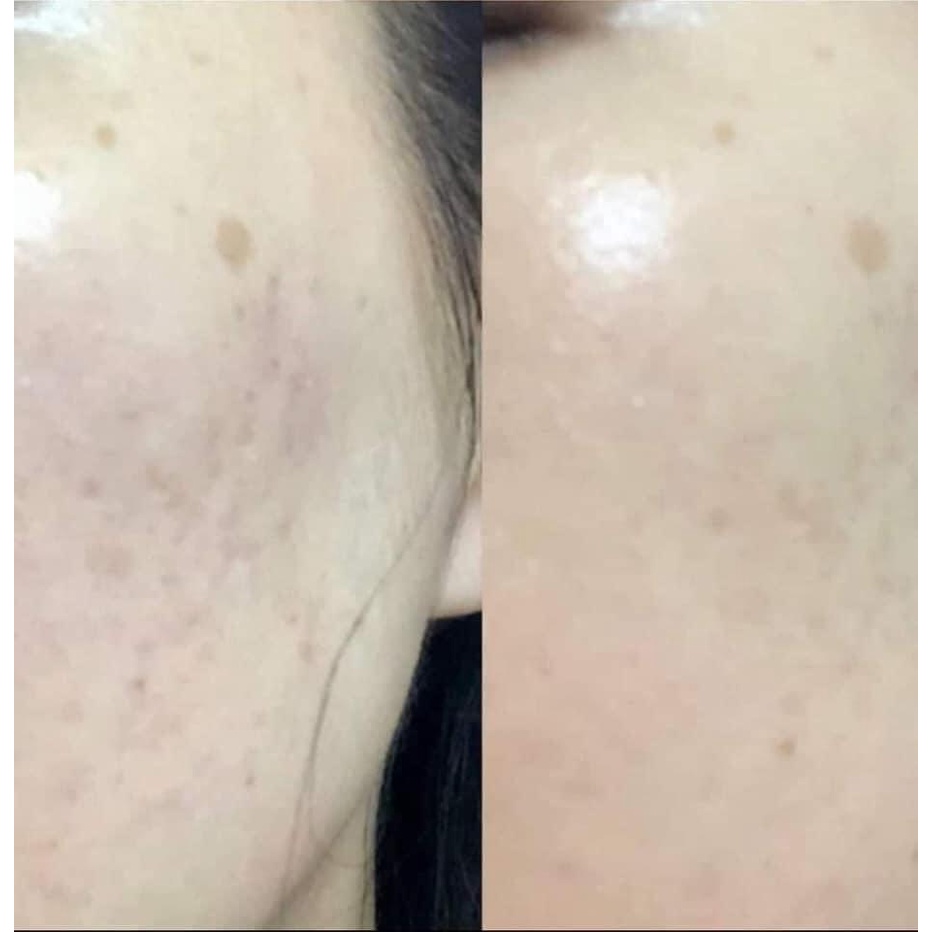 [GIẢM 5% ĐƠN 129K]Serum Neoretin Discrom Control Booster