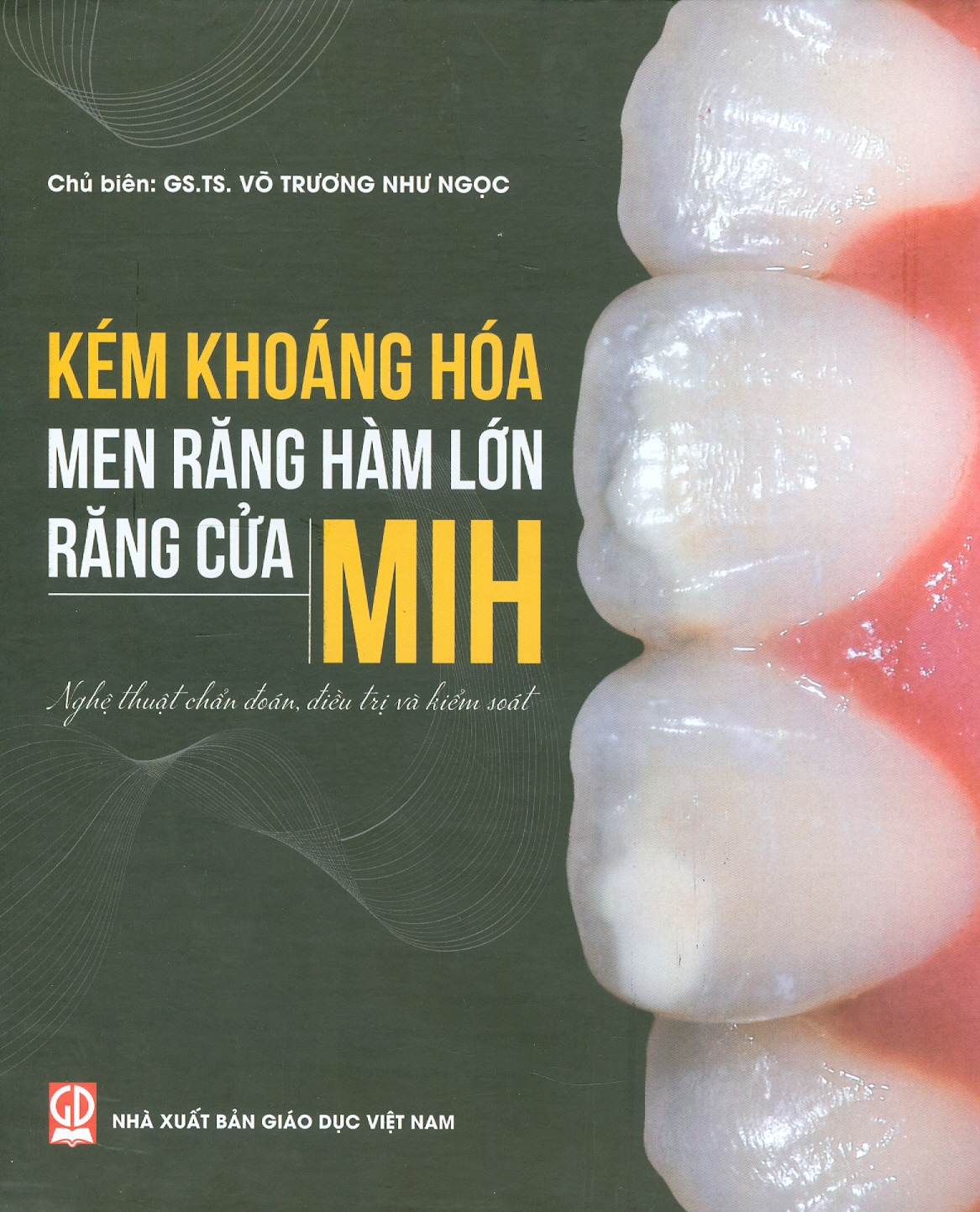 Kém khoáng hoá men răng hàm lớn - răng cửa mih: nghệ thuật chẩn đoán, điều trị và kiểm soát