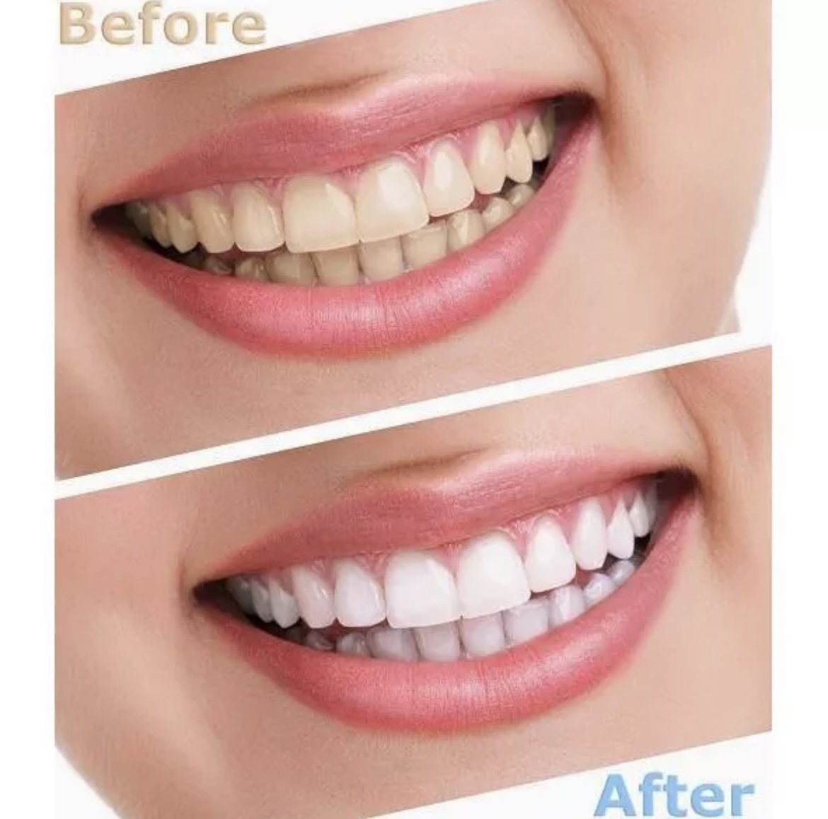 Kem Đánh Răng Crest 3D White Advanced Triple Whitening 147Gr