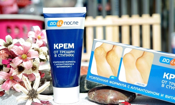 Kem bôi nứt nẻ gót chân Apteka Nga 50ml