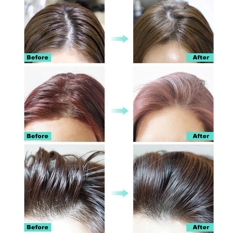 [Nhacuabeautyholic] Phấn hút dầu tóc APIEU OILY HAIR DRY POWDER