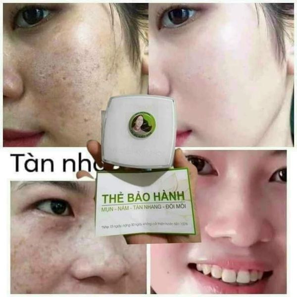 Kem Face Nám Hà Kiều Anh (hàng chuẩn 100%)