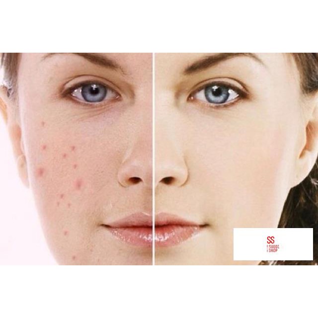 Tinh chất trị thâm,nám,trắng da Serum Cc Melano Rohto