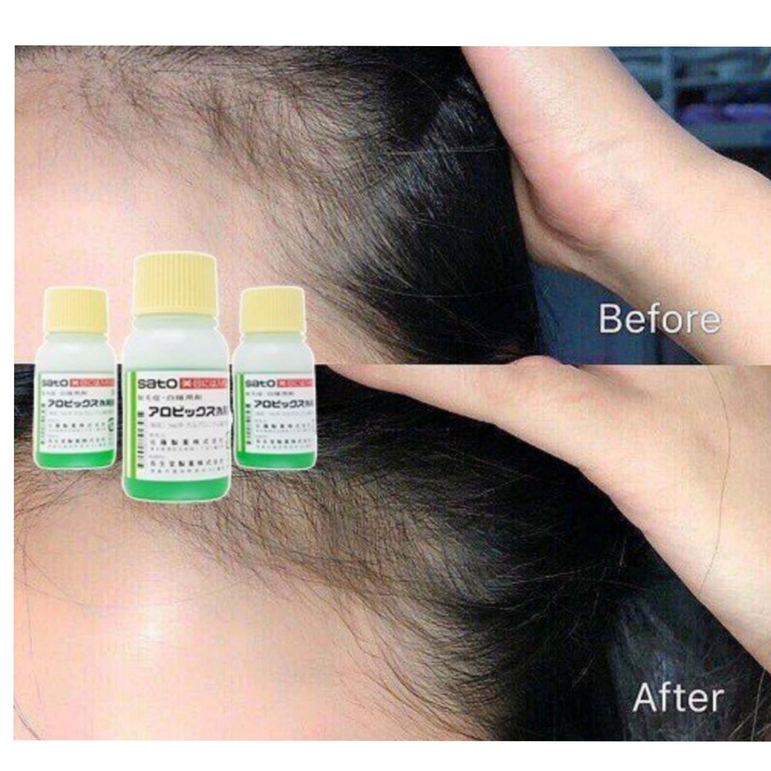 [Chính hãng] Tinh chất Mọc Tóc SATO Arovics Solutions 5% Nhật Bản 30ml