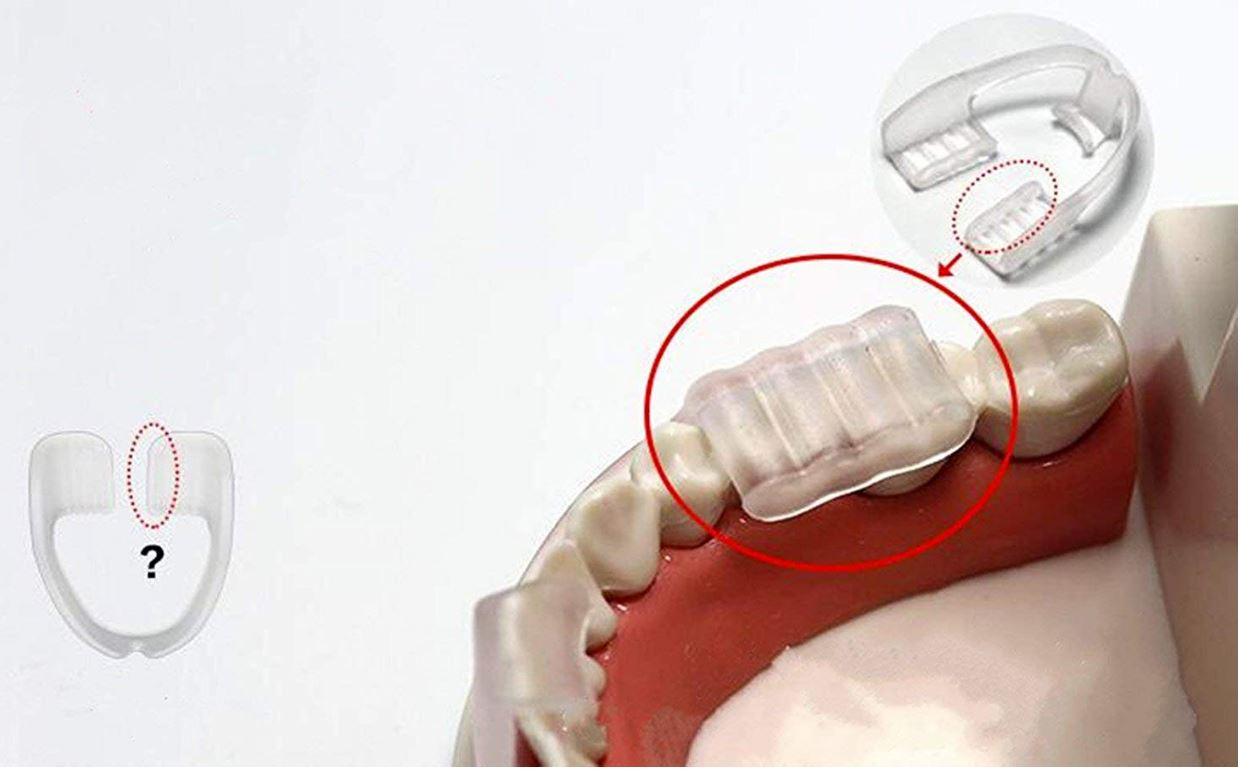 [HCM]Dụng cụ chống nghiến răng và bảo vệ răng miệng#CNN