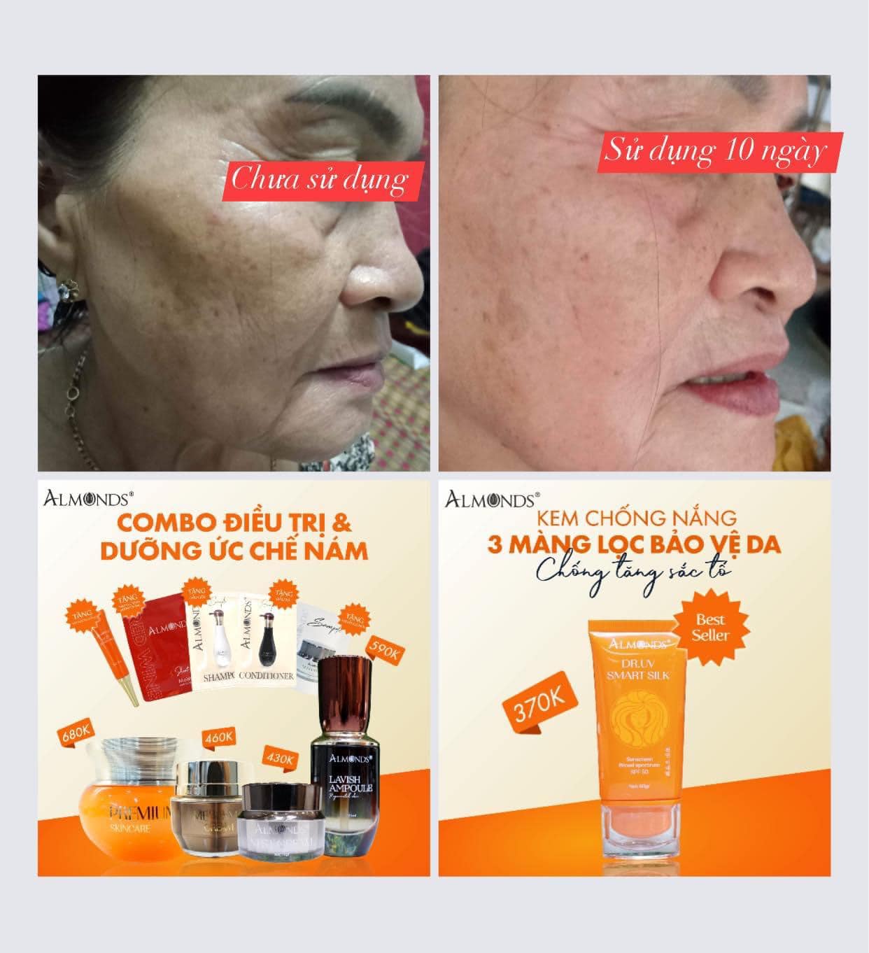 Serum Tế Bào Gốc Phục Hồi Da Almonds Lavish Ampoule