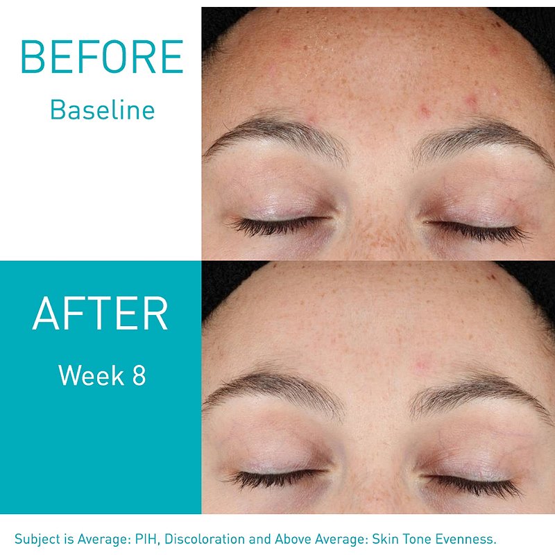 CeraVe Resurfacing Retinol Serum (30mL)