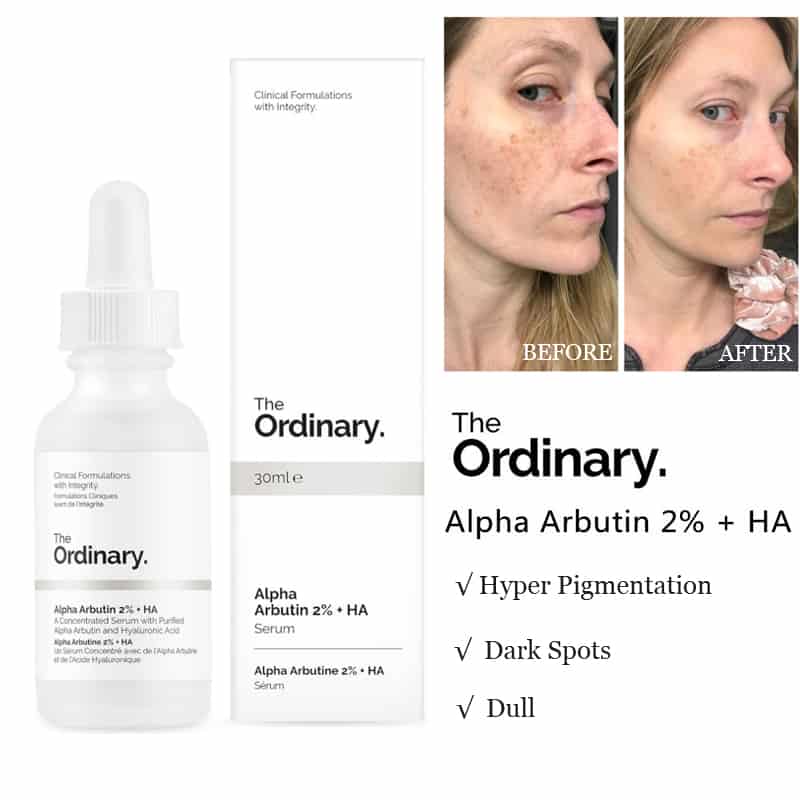 Serum Dưỡng Da Alpha Aburtin 2% + HA - The ordinary 30ml