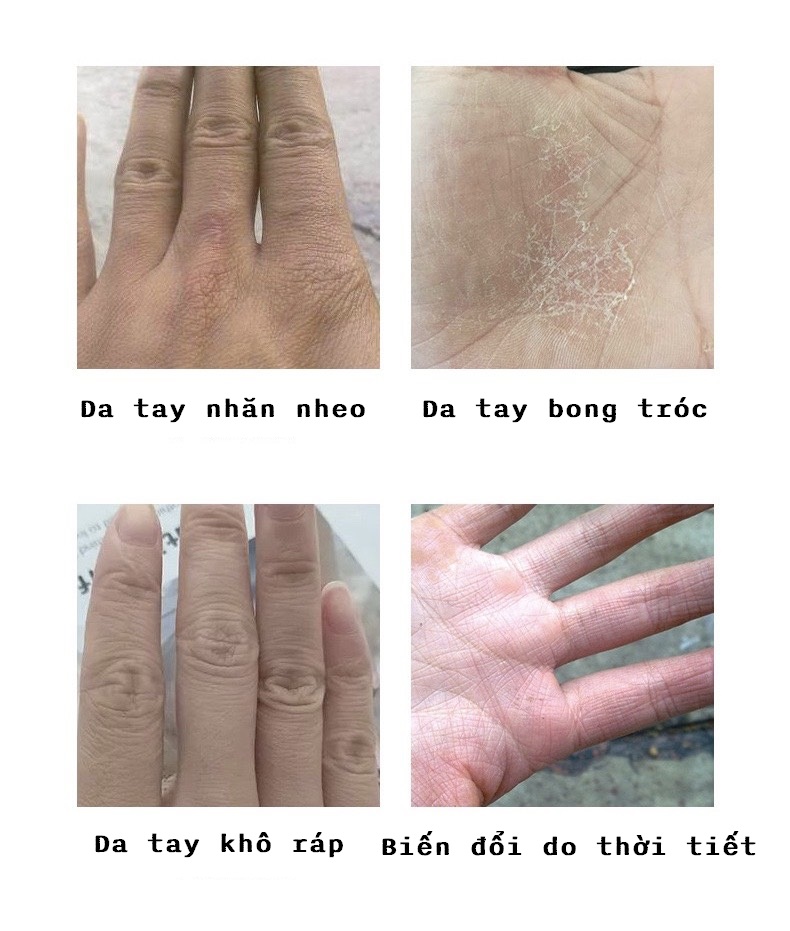Serum Dưỡng da tay Yinba cao cấp