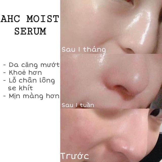 [HCM]Tinh Chất AHC Capture Solution Prime Ampoule mẫu mới