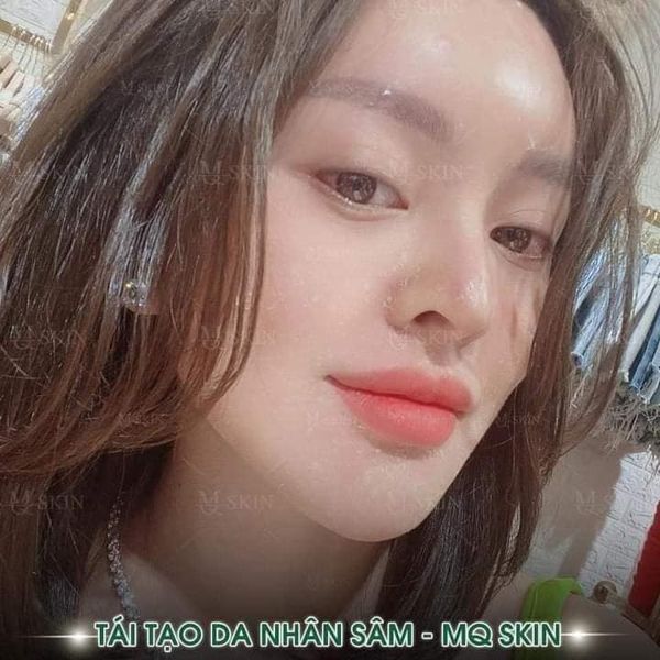 SERUM TÁI TẠO DA NHÂN SÂM MQ-SKIN ( chính hãng )