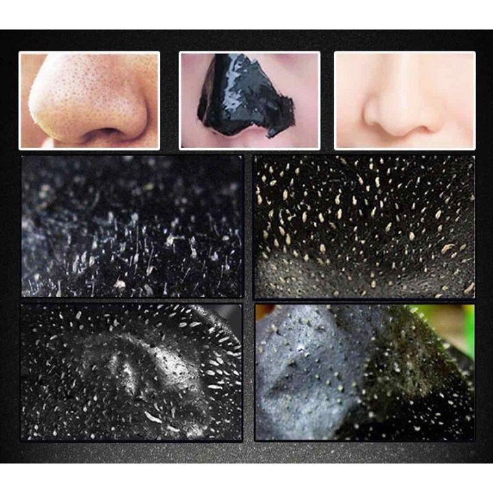 FREESHIP- Gel lột mụn than tre hoạt tính