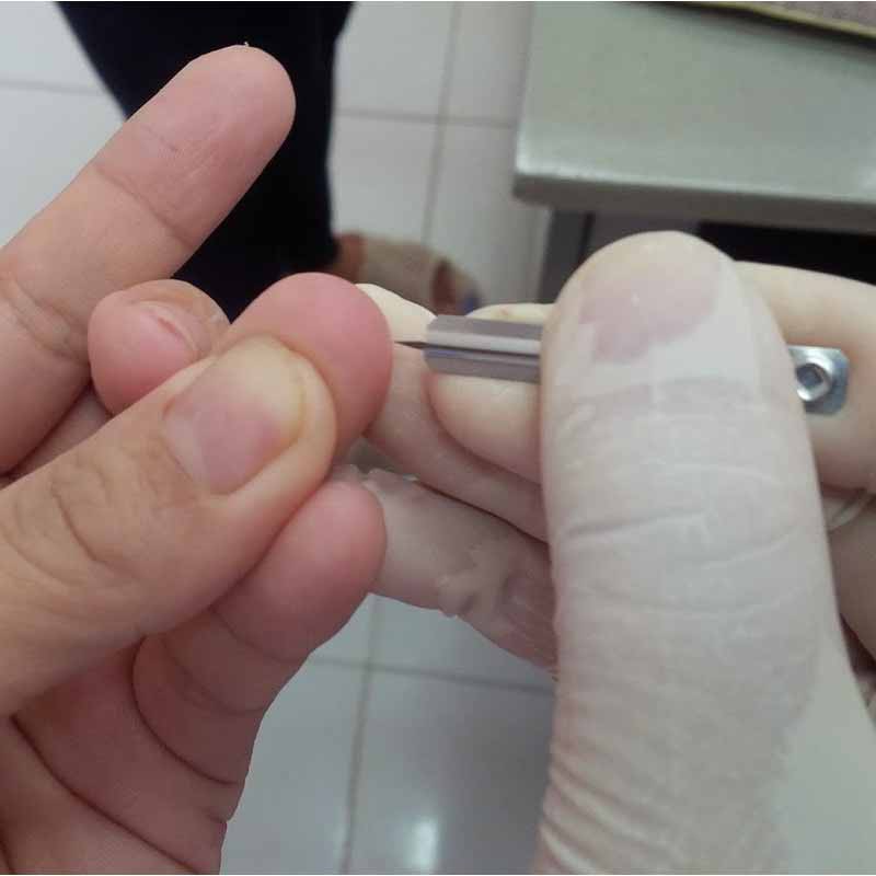 Kim nặn mụn chích máu Blood Lancets 200 chiếc