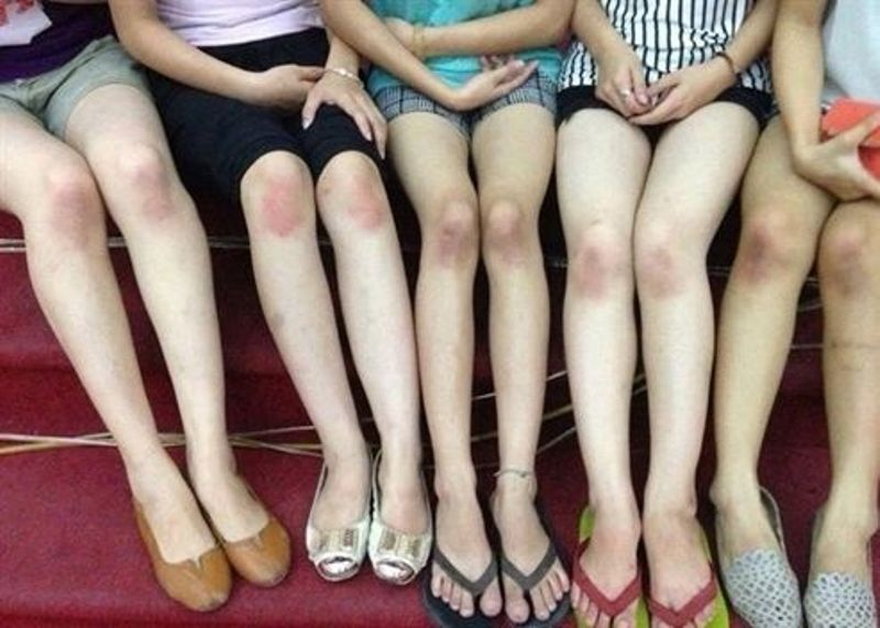 Kem Trị Thâm Đầu Gối, Thâm Khuỷu Tay, Nách, Thâm Chân Tay.