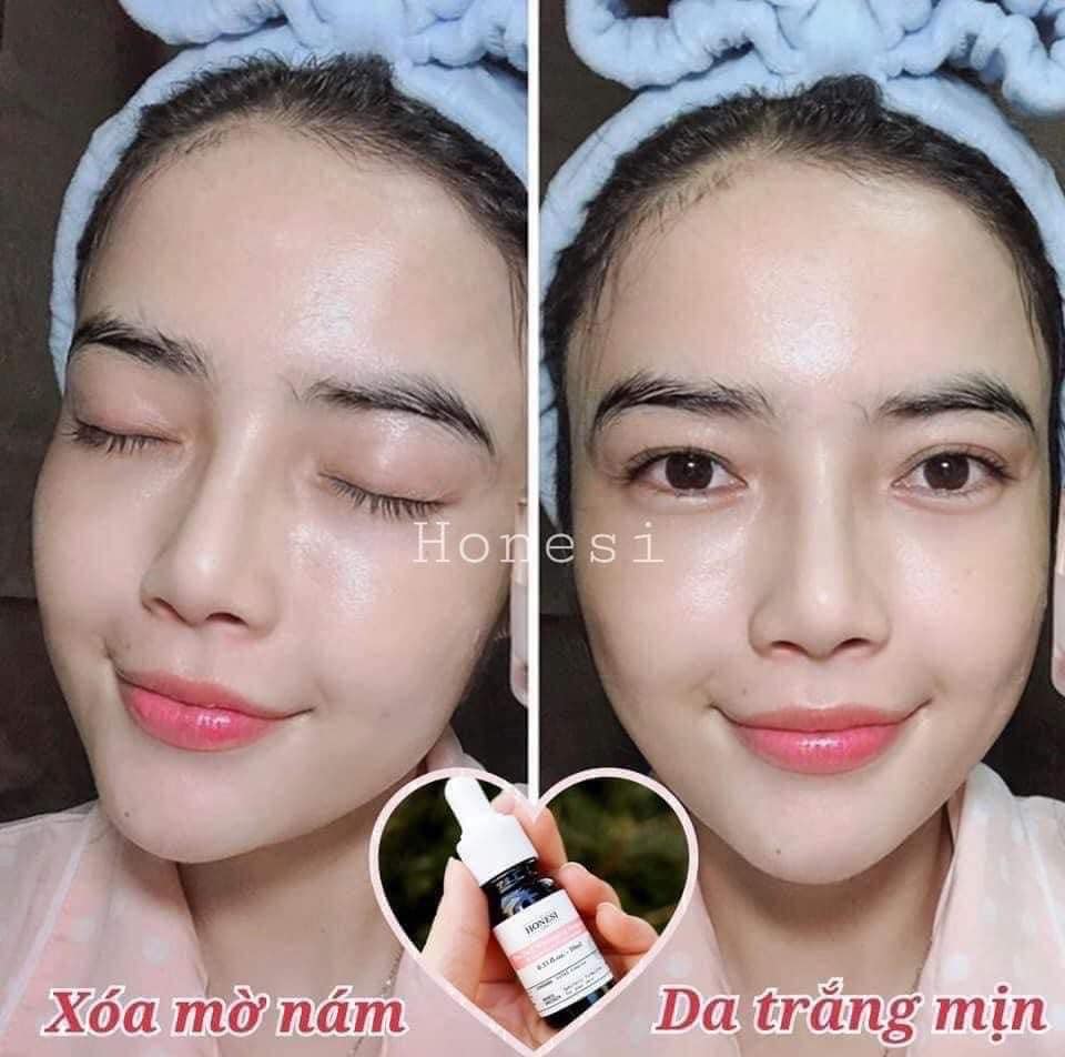 Serum Nám Honesi 10ml