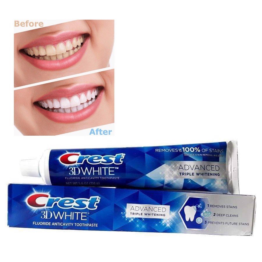 Kem đánh răng Crest 3D White Advanced Whitening 147g