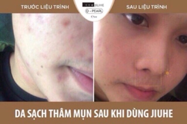 Serum jiuhe Hàn quốc
