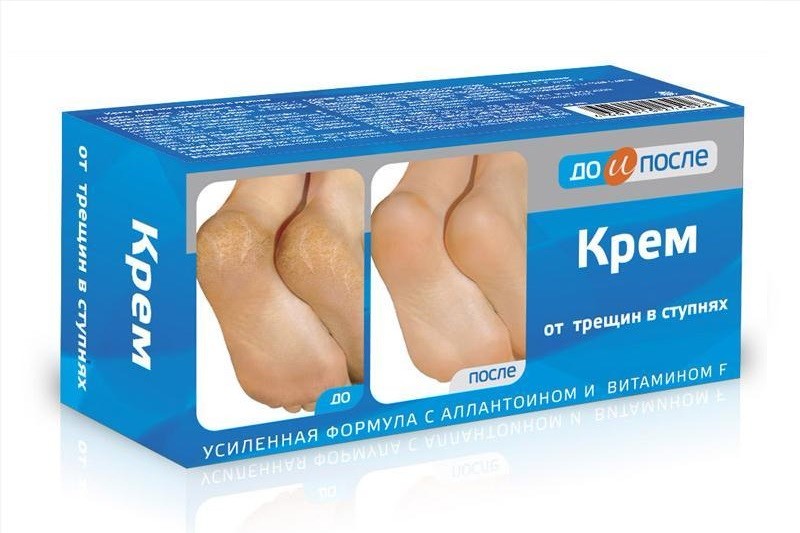 Kem tri nứt gót chân kpem apteka nga - ktngc kpem