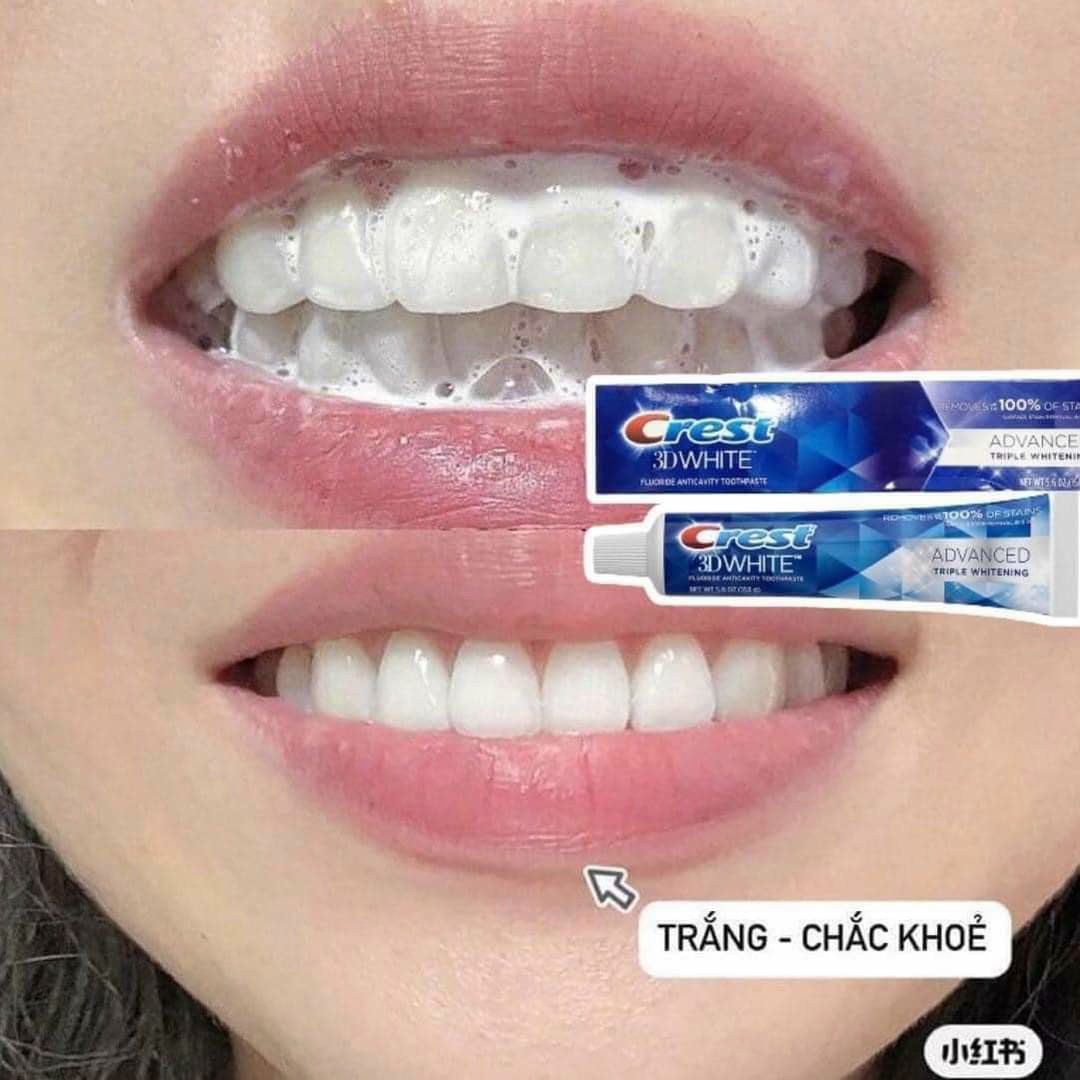 Kem đánh răng Crest 3D White 198g của Mỹ