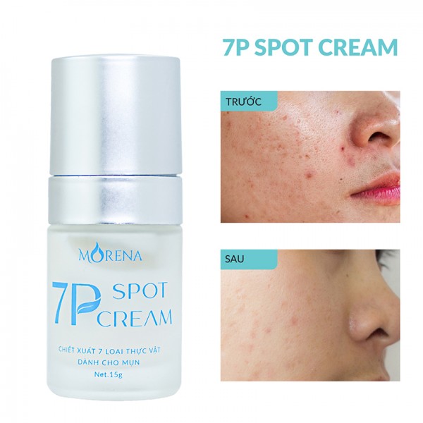 Kem chấm mụn 7P Spot Cream Huyền Phi